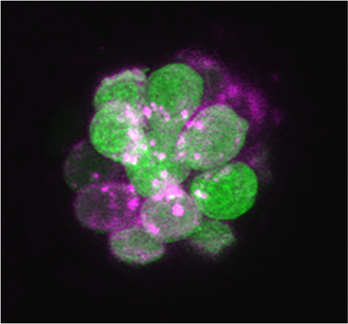 hair cells