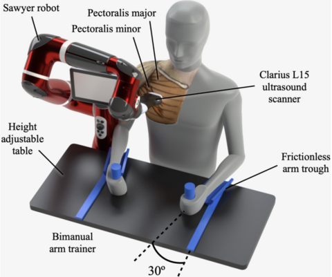 Illustration of in vivo ultrasound data acquisition from a research participant with post-stroke shoulder pain