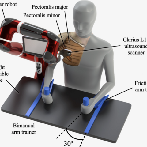 Illustration of in vivo ultrasound data acquisition from a research participant with post-stroke shoulder pain