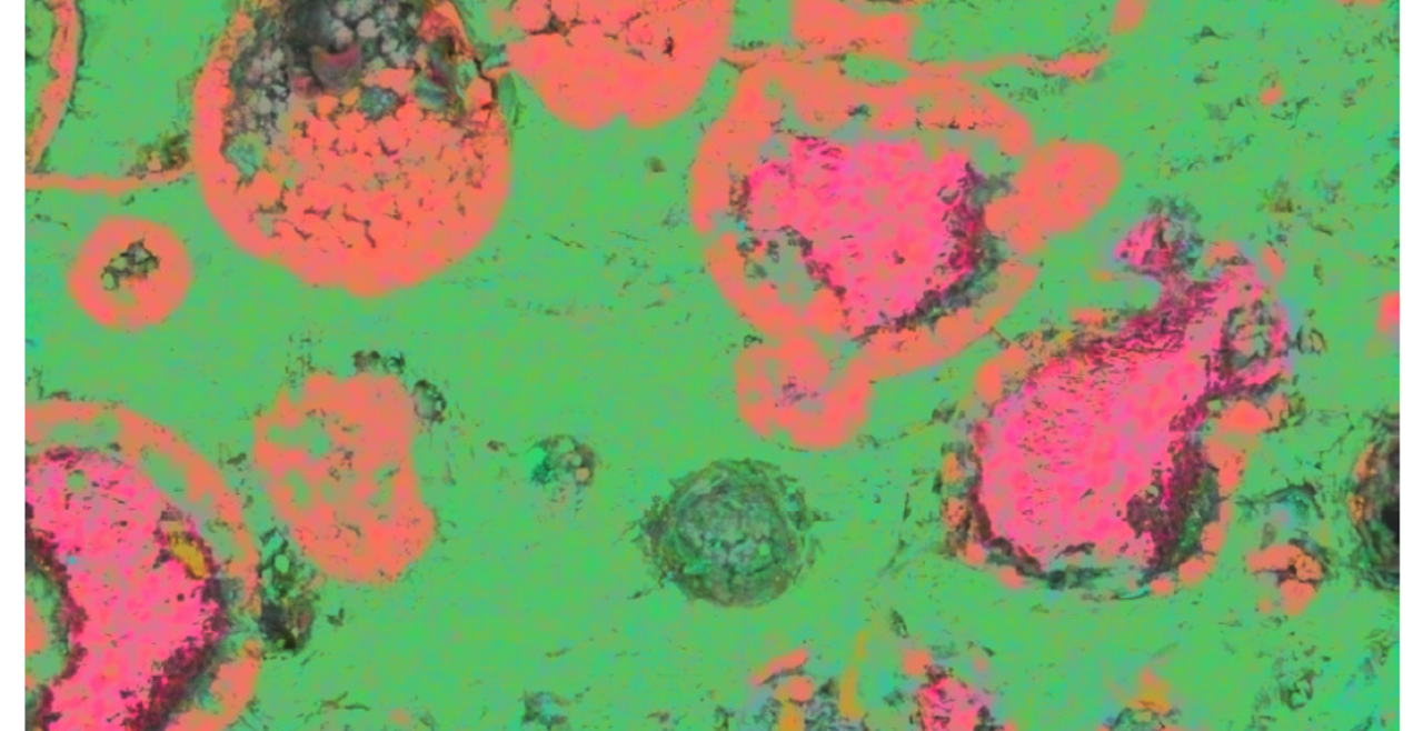 Bright green background with pink and orange circular areas showing the distribution of elements in a vesicular rock