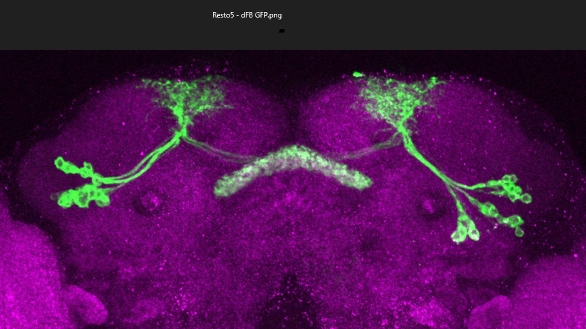 Drosophila brain showing GFP expression in dFB neurons