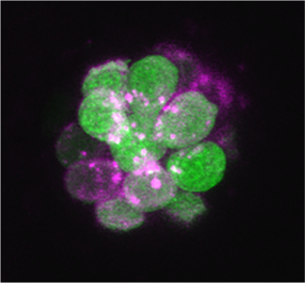 hair cells
